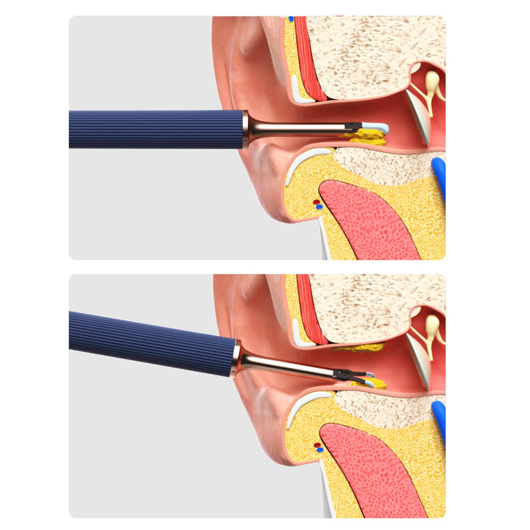 Mi Bebird Note3 Endoscopic Cleaner